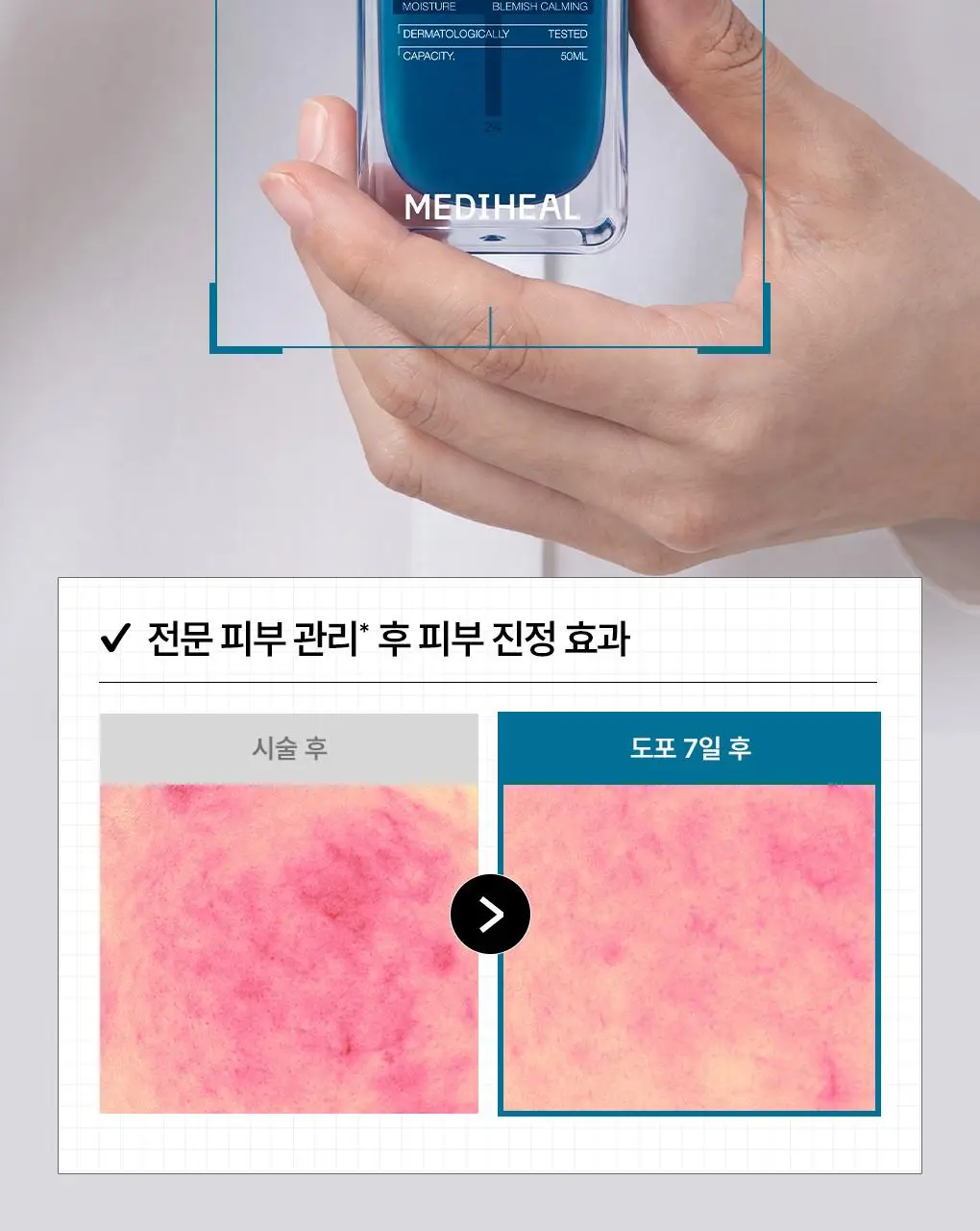 [업그레이드 수분흔적세럼] 메디힐 마데카소사이드 더마 세럼 50mL 상세페이지 10